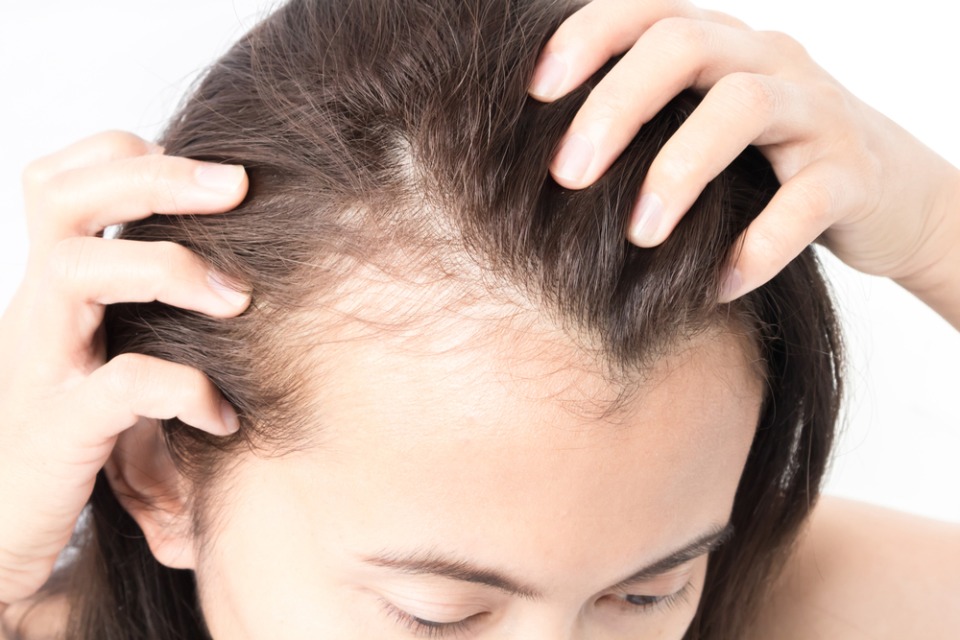Hair transplant Istanbul with Advanced DHI Pen Technique
